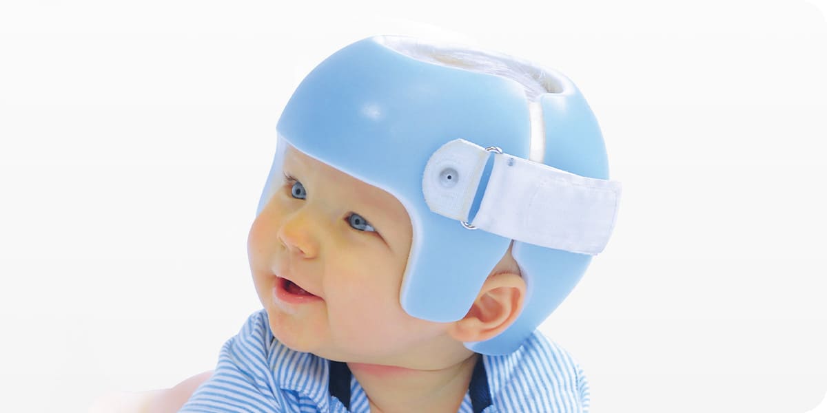 赤ちゃんの頭の形外来